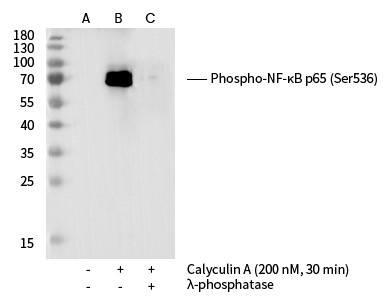 Recombinant Phospho-NF-κB p65 (Ser536) Monoclonal Antibody (AN300381L)