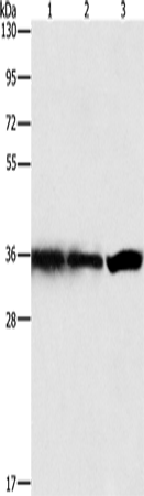 GNB1 Polyclonal Antibody (E-AB-10332)