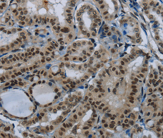 DAN Polyclonal Antibody (E-AB-11421)