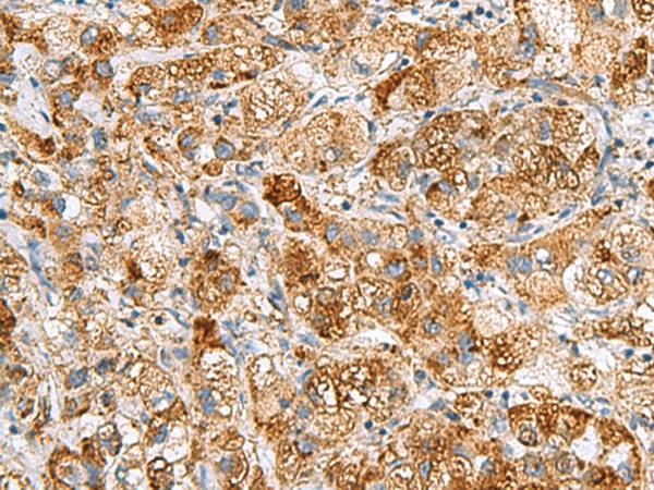 NMU Polyclonal Antibody (E-AB-19146)