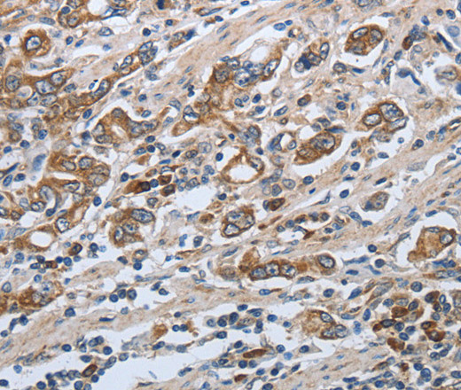 SLC34A2 Polyclonal Antibody (E-AB-15851)