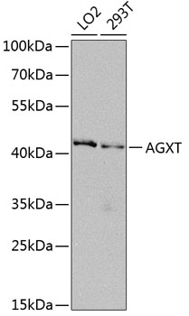 AGXT Polyclonal Antibody (E-AB-62617)