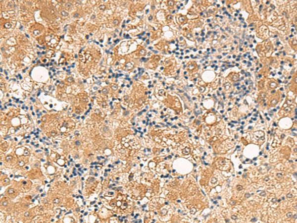 FUNDC2 Polyclonal Antibody (E-AB-52840)