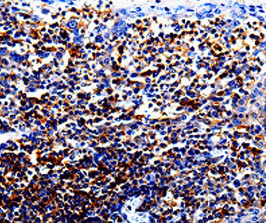 IL10RA Polyclonal Antibody (E-AB-13869)