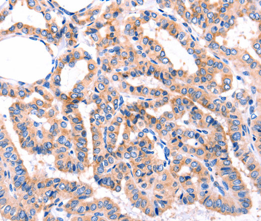 GRK2 Polyclonal Antibody (E-AB-15703)