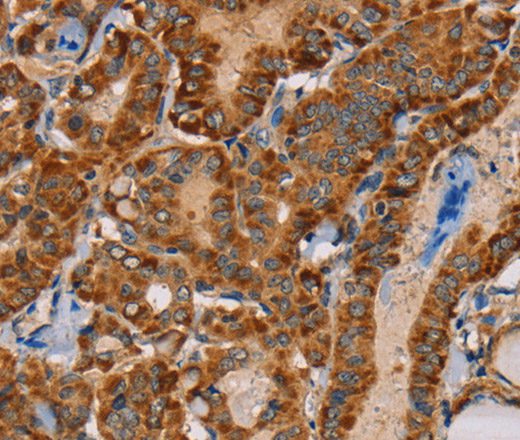 MBNL3 Polyclonal Antibody (E-AB-11383)