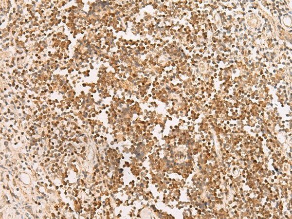 PAX5 Polyclonal Antibody (E-AB-19303)