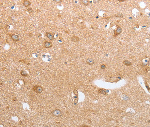 CASP12 Polyclonal Antibody (E-AB-12302)