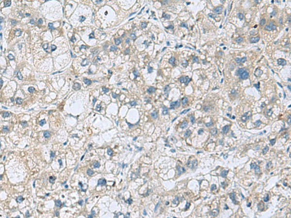 KCNJ2 Polyclonal Antibody (E-AB-52110)