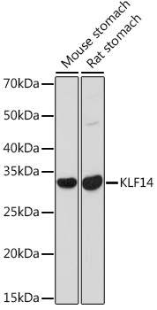 KLF14 Polyclonal Antibody (E-AB-92100)
