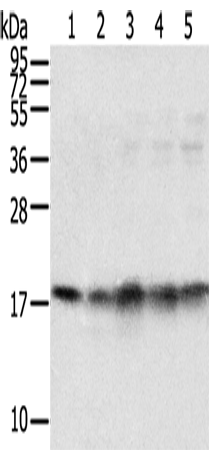 TAF11 Polyclonal Antibody (E-AB-11627)