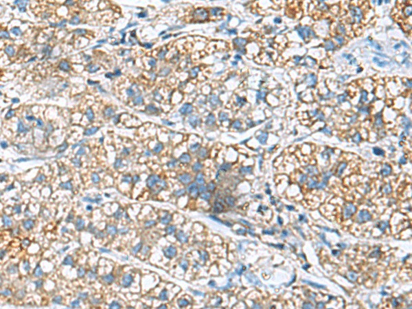 JOSD1 Polyclonal Antibody (E-AB-53080)