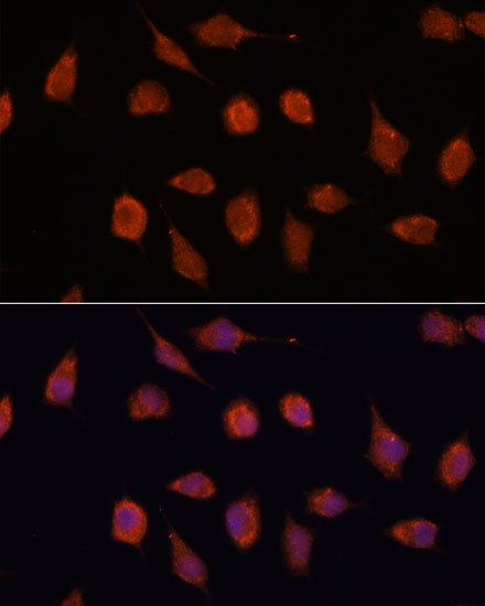 KCNAB2 Polyclonal Antibody (E-AB-66729)