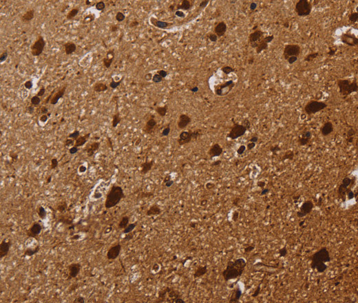 KARS Polyclonal Antibody (E-AB-15151)