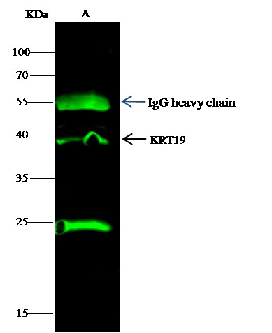 KRT19 Monoclonal Antibody (AN200158P)