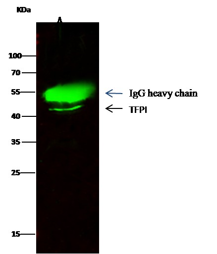 Recombinant TFPI/LACI/EPI Monoclonal Antibody (AN300196P)