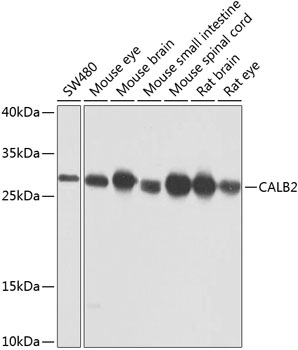 CALB2 Polyclonal Antibody (E-AB-62649)
