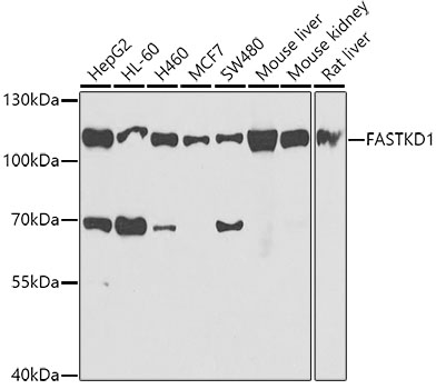 FASTKD1 Polyclonal Antibody (E-AB-62520)