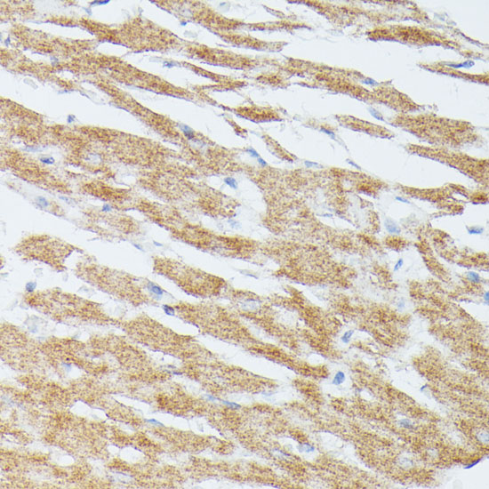 MAP2K5 Polyclonal Antibody (E-AB-61428)