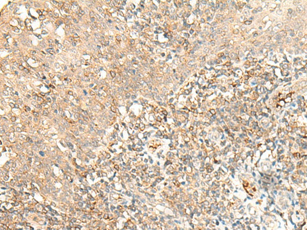 MOB3B Polyclonal Antibody (E-AB-17938)