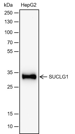 Recombinant SUCLG1 Monoclonal Antibody (AN302017L)