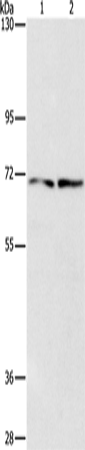 IFT74 Polyclonal Antibody (E-AB-13159)
