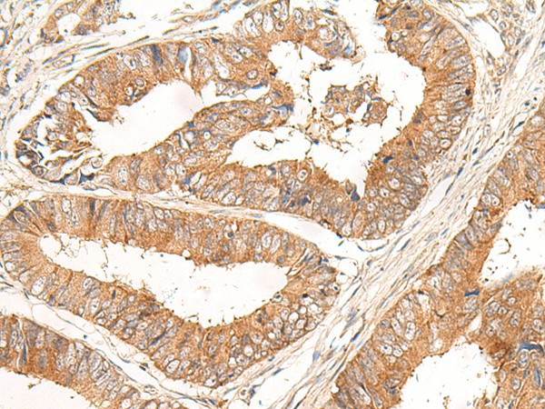 CORO2A Polyclonal Antibody (E-AB-52651)