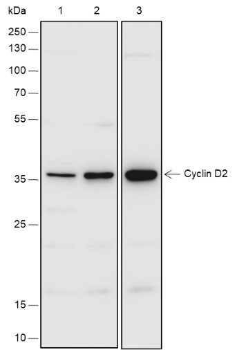 Recombinant Cyclin D2 Monoclonal Antibody (AN301830L)