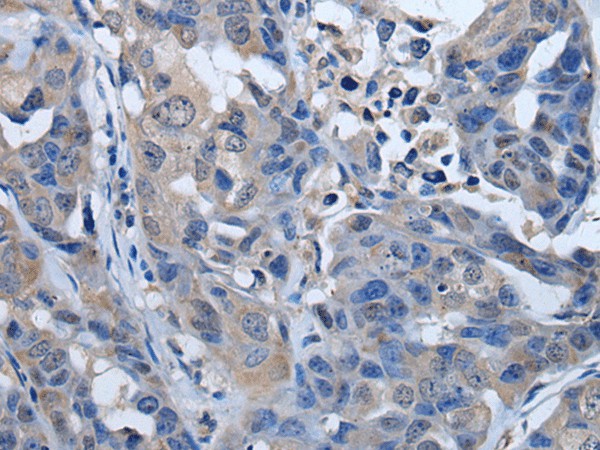 PLK4 Polyclonal Antibody (E-AB-18272)
