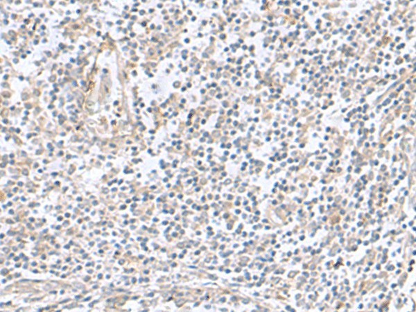 TNNC2 Polyclonal Antibody (E-AB-53052)
