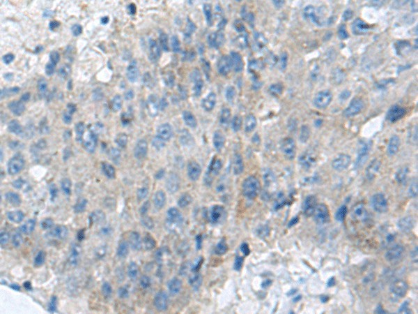 KIAA0556 Polyclonal Antibody (E-AB-18186)