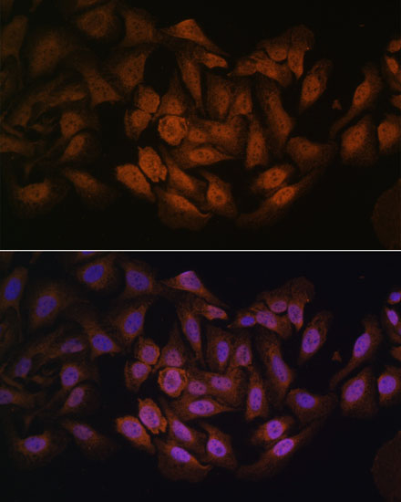 CNBP Polyclonal Antibody (E-AB-65202)