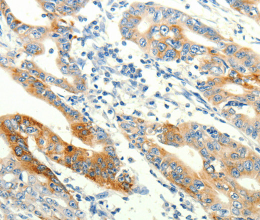 TRPA1 Polyclonal Antibody (E-AB-16104)