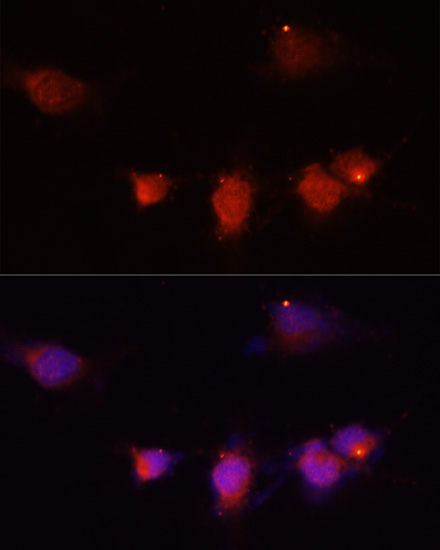 NPY Polyclonal Antibody (E-AB-66417)