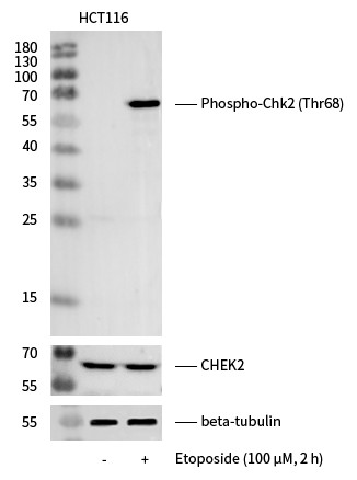 Recombinant Phospho-Chk2 (Thr68) Monoclonal Antibody (AN300151L)