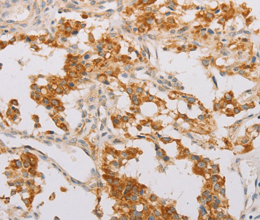 STK40 Polyclonal Antibody (E-AB-14693)