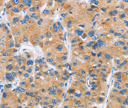 DKK2 Polyclonal Antibody (E-AB-10286)