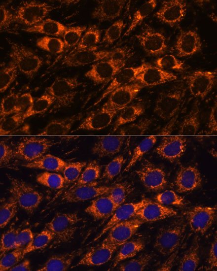 ACAA2 Polyclonal Antibody (E-AB-66571)