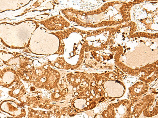 GTF3C3 Polyclonal Antibody (E-AB-18064)