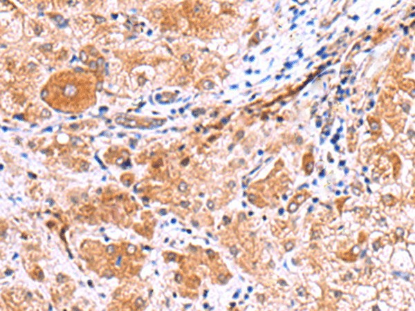 IRGC Polyclonal Antibody (E-AB-18127)