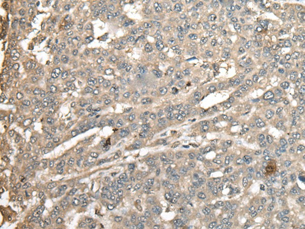 ATXN3 Polyclonal Antibody (E-AB-18525)
