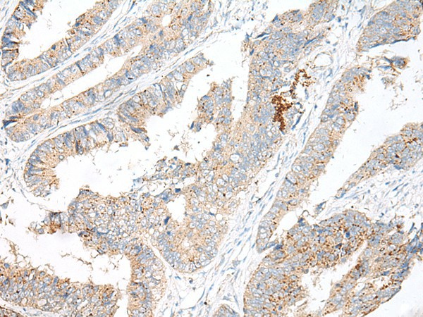 GARNL3 Polyclonal Antibody (E-AB-17988)