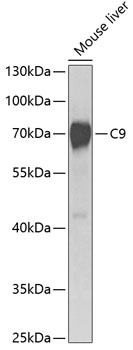 C9 Polyclonal Antibody (E-AB-62019)