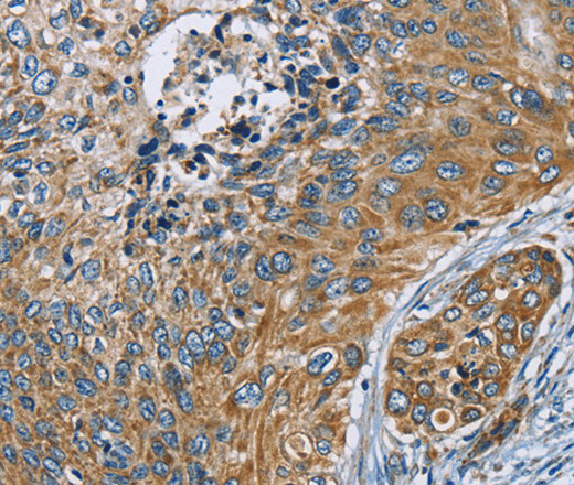 ZMYND11 Polyclonal Antibody (E-AB-11012)