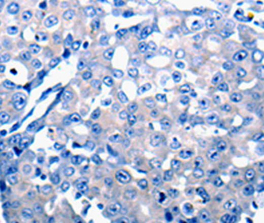 CCL2 Polyclonal Antibody (E-AB-12307)