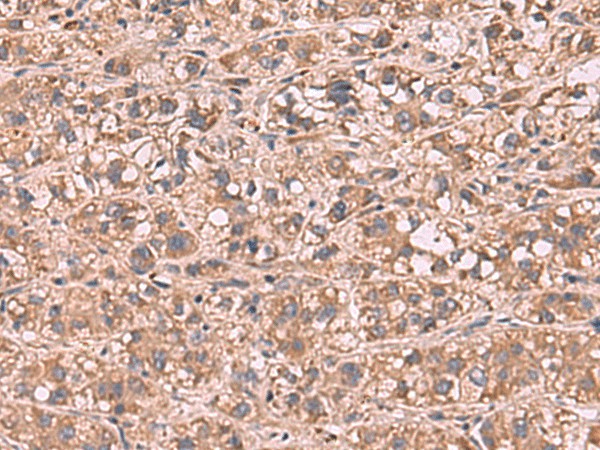 SHC4 Polyclonal Antibody (E-AB-52995)