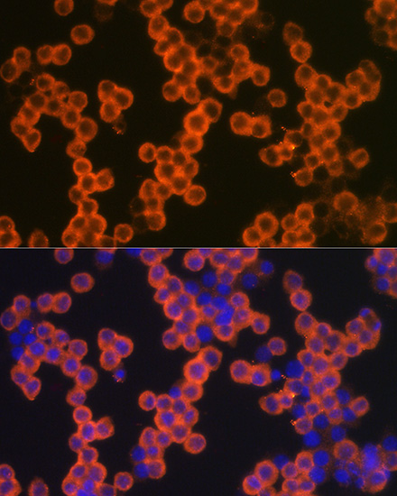 CD38 Polyclonal Antibody (E-AB-66945)