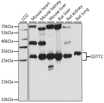 GSTT2 Polyclonal Antibody (E-AB-91242)