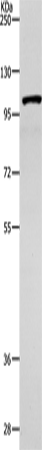 TNK2 Polyclonal Antibody (E-AB-12226)