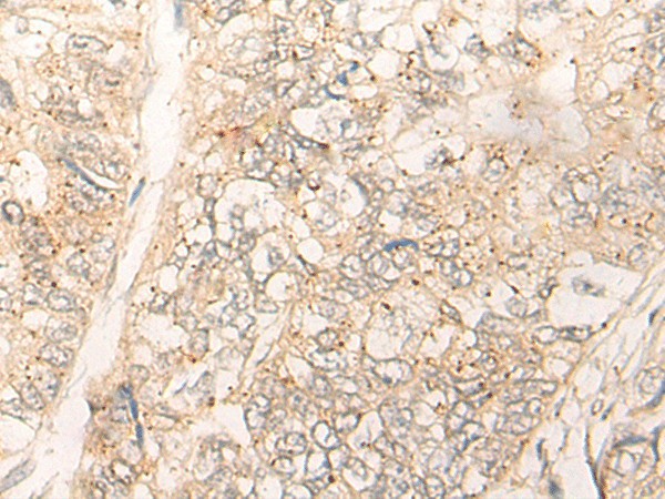 CUTA Polyclonal Antibody (E-AB-18633)